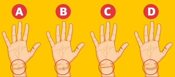 右手を開いて、あなたの手首のしわに似ているものを選んでください。